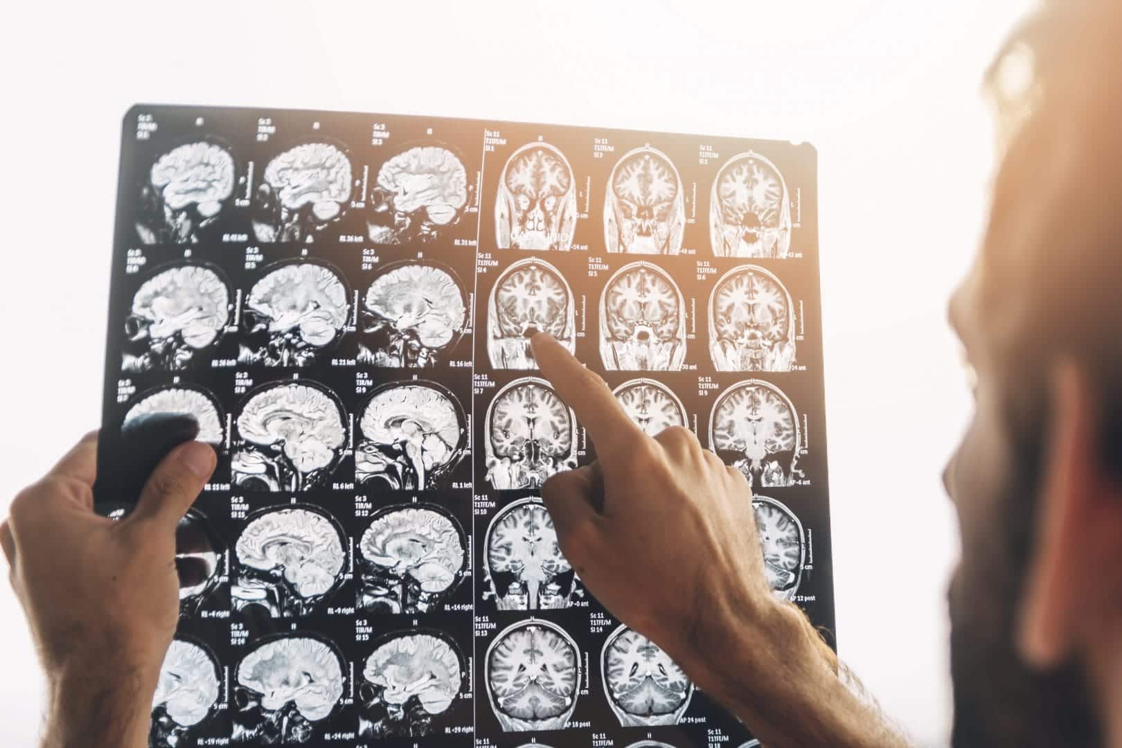 brain scan image
