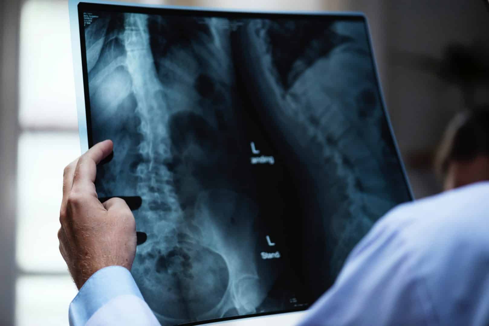 Xray film